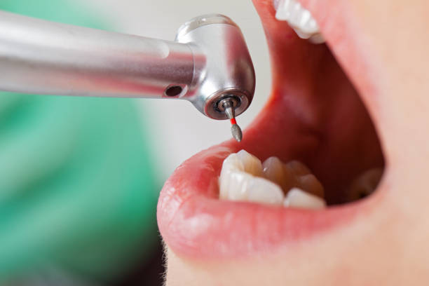 Best Cosmetic Emergency Dentistry in Forest, OH